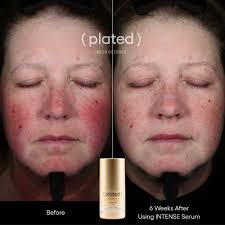 Plated Intense Serum