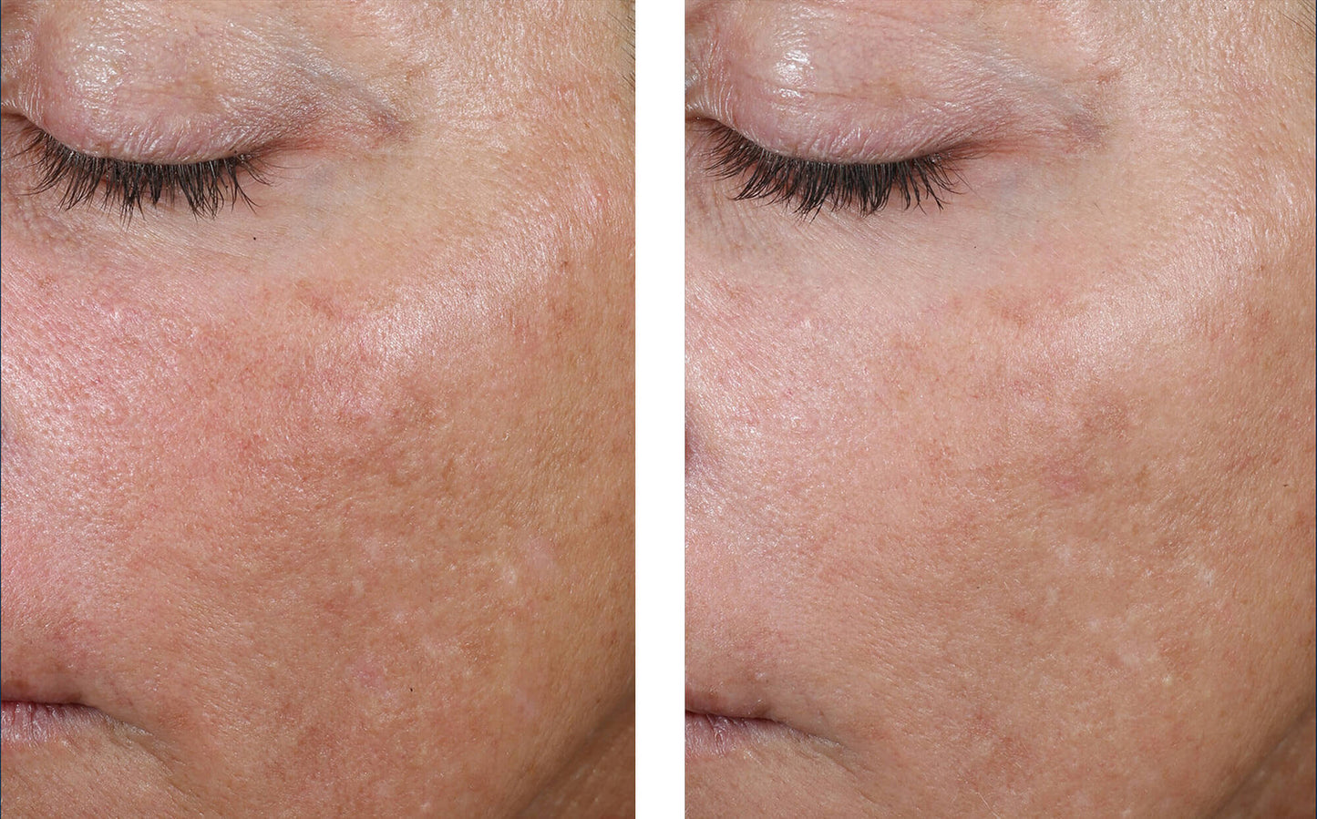 AlphaRet Overnight 30ML