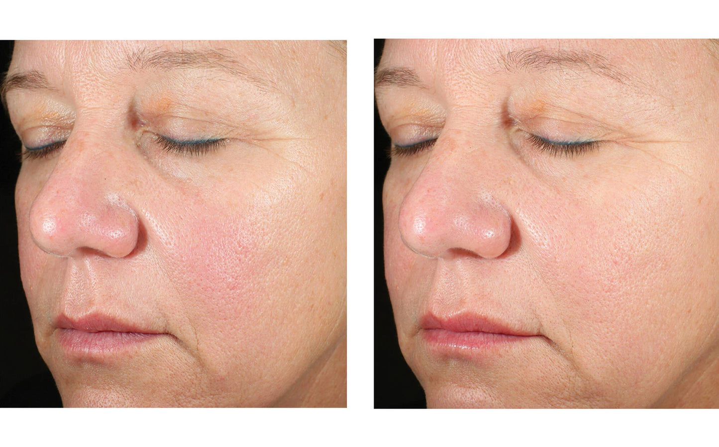 Alto Advanced Defense and Repair Serum